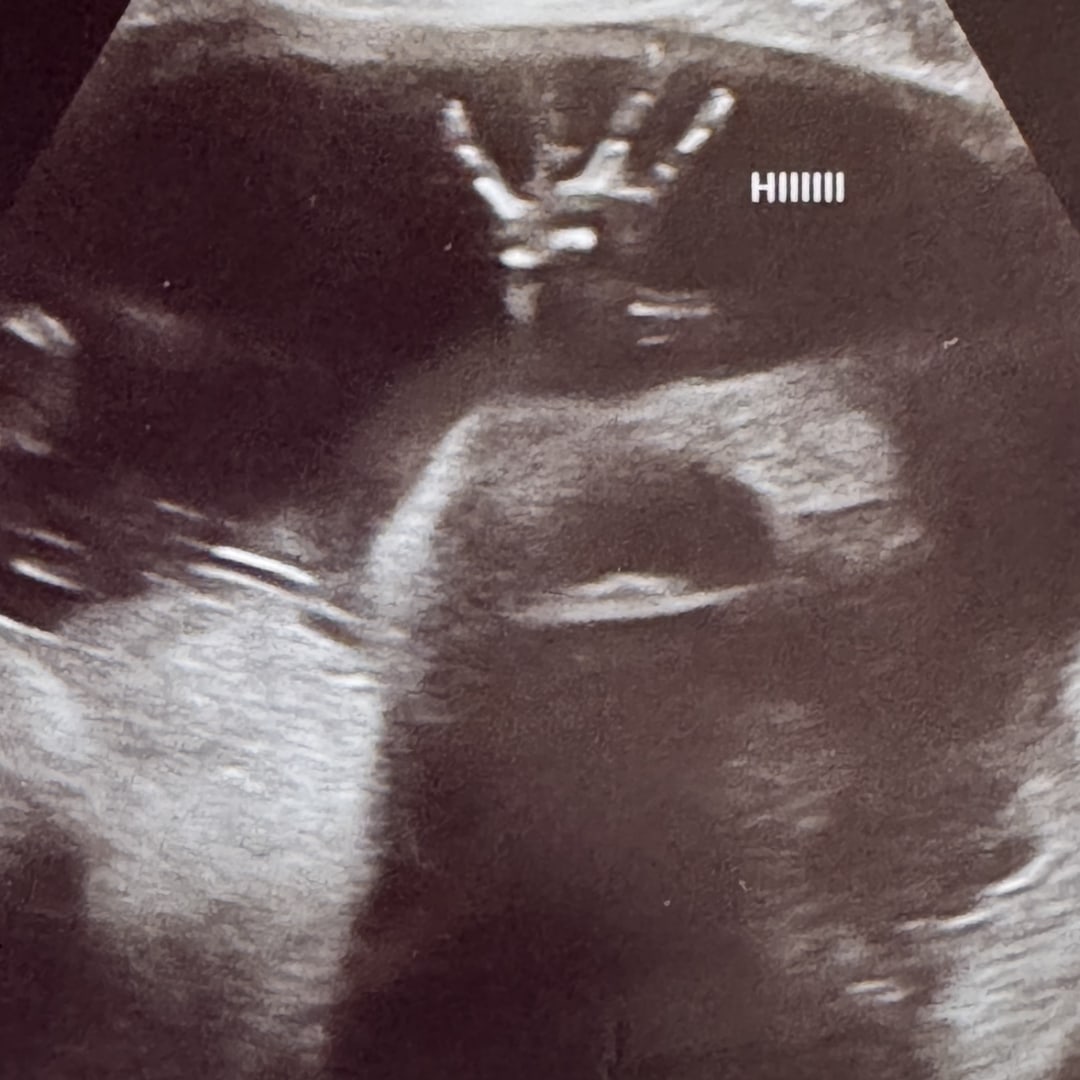 Photo shared by Vanessa for their Babylist baby registry.