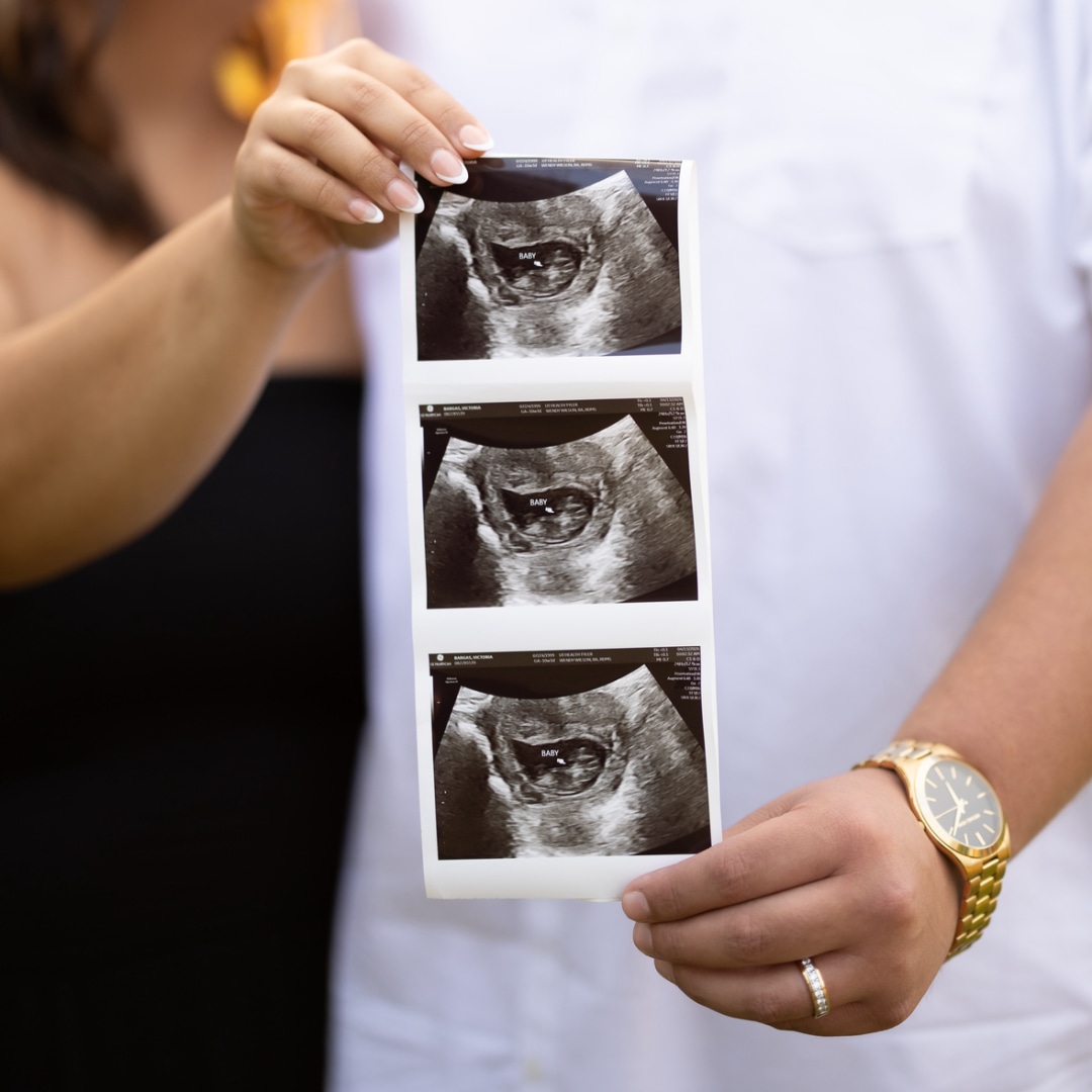 Photo shared by Victoria for their Babylist baby registry.