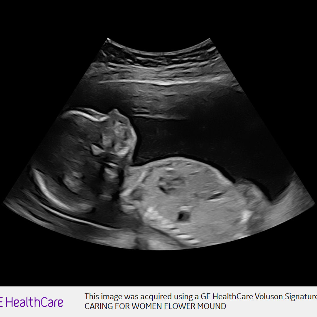 Photo shared by Sable for their Babylist baby registry.