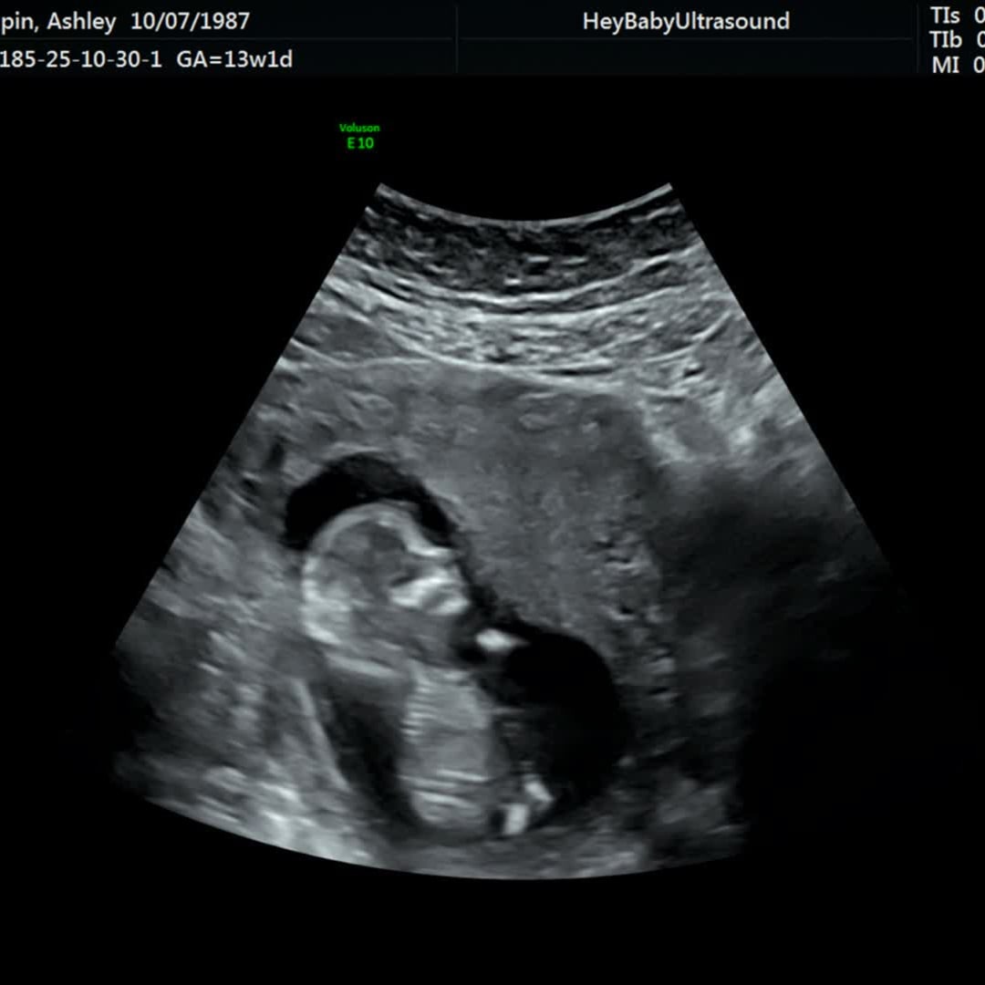 Photo shared by Ashley for their Babylist baby registry.