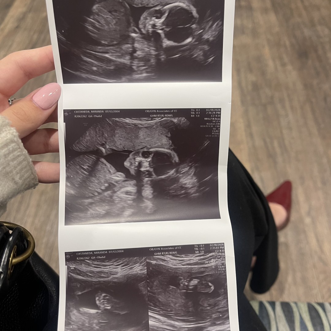 Photo shared by Alexandria for their Babylist baby registry.