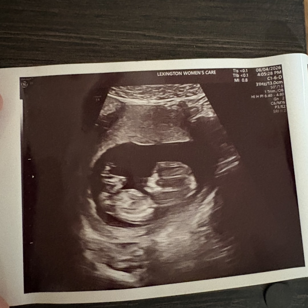 Photo shared by Ashlyn for their Babylist baby registry.