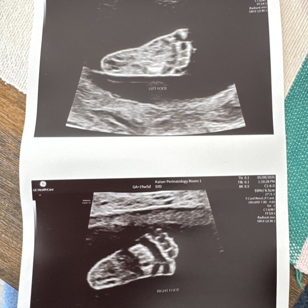 Photo shared by Allison for their Babylist baby registry.