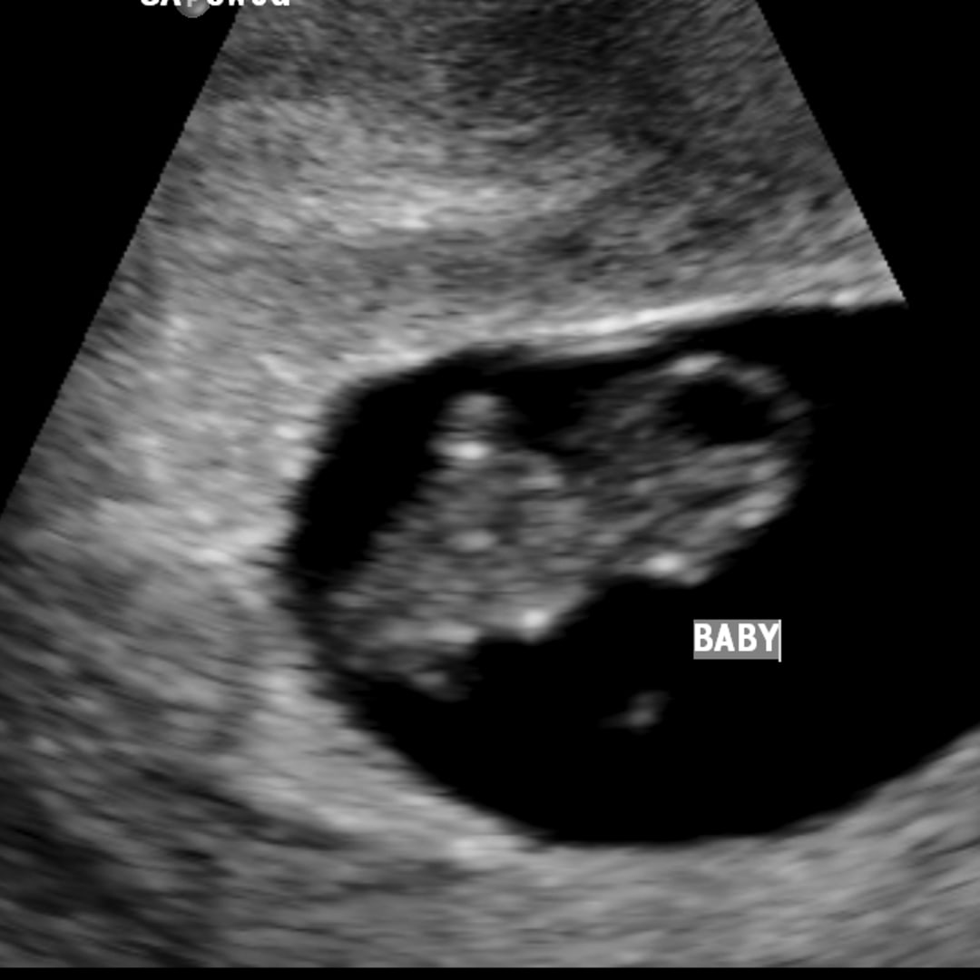 Photo shared by Kelsey for their Babylist baby registry.