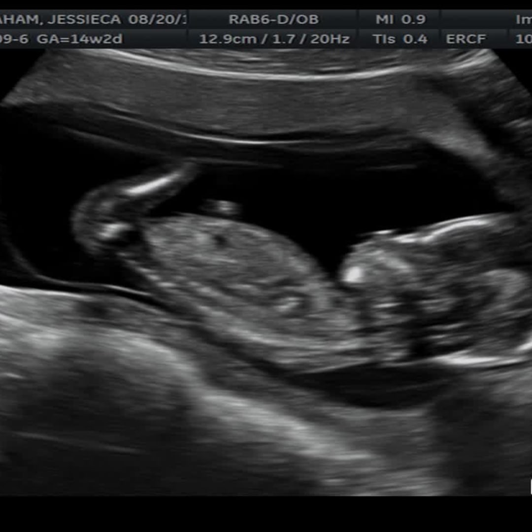 Photo shared by Jessieca for their Babylist baby registry.