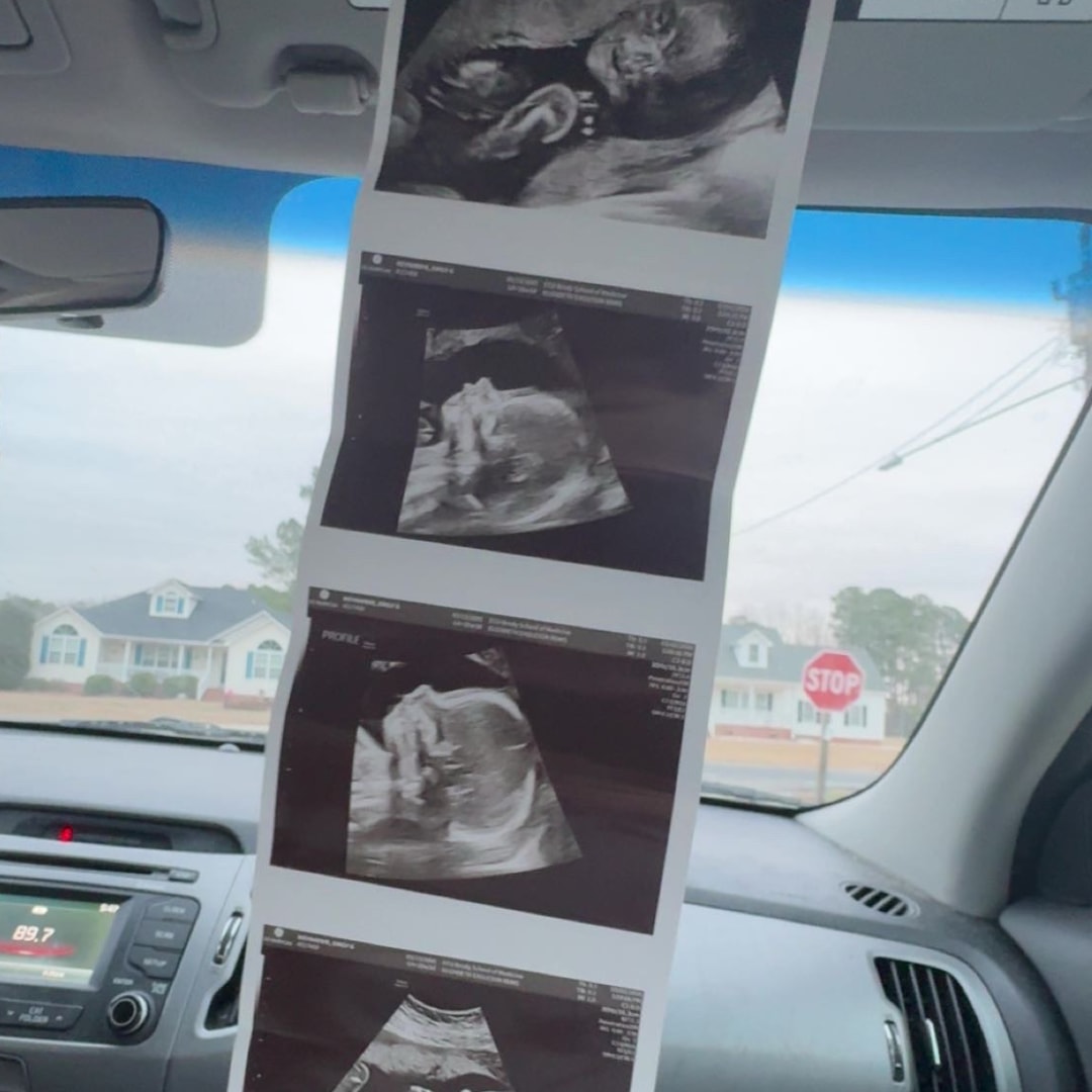 Photo shared by Emily for their Babylist baby registry.