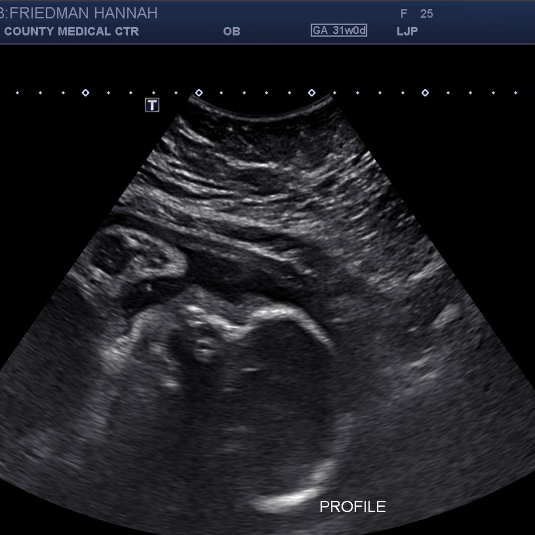 Photo shared by Hannah for their Babylist baby registry.