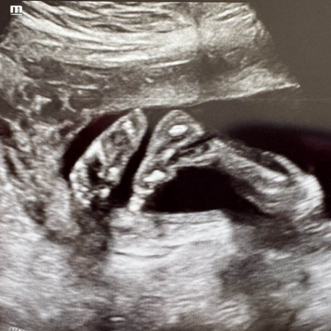 Photo shared by Helena for their Babylist baby registry.