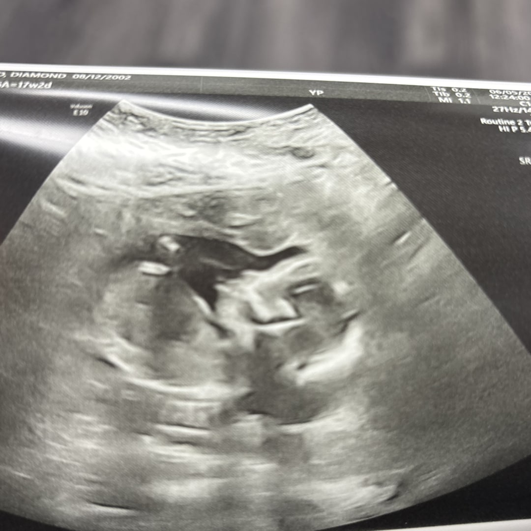 Photo shared by Diamond for their Babylist baby registry.