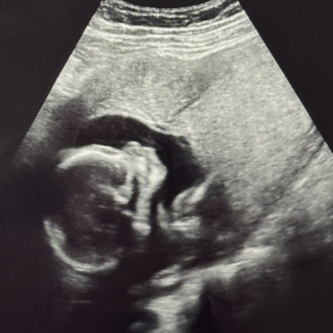 Photo shared by Mariah for their Babylist baby registry.
