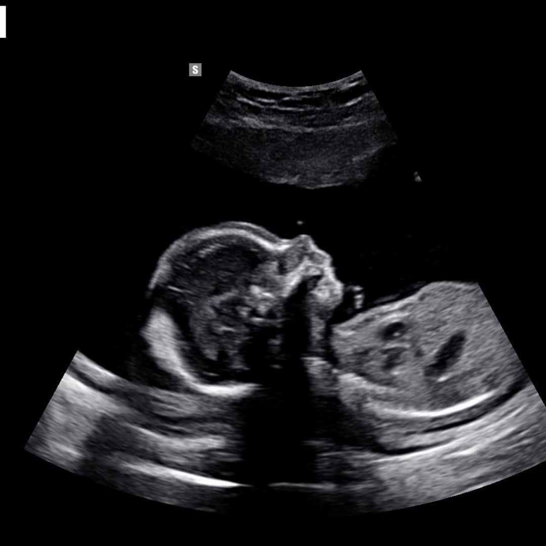 Photo shared by Atlee for their Babylist baby registry.