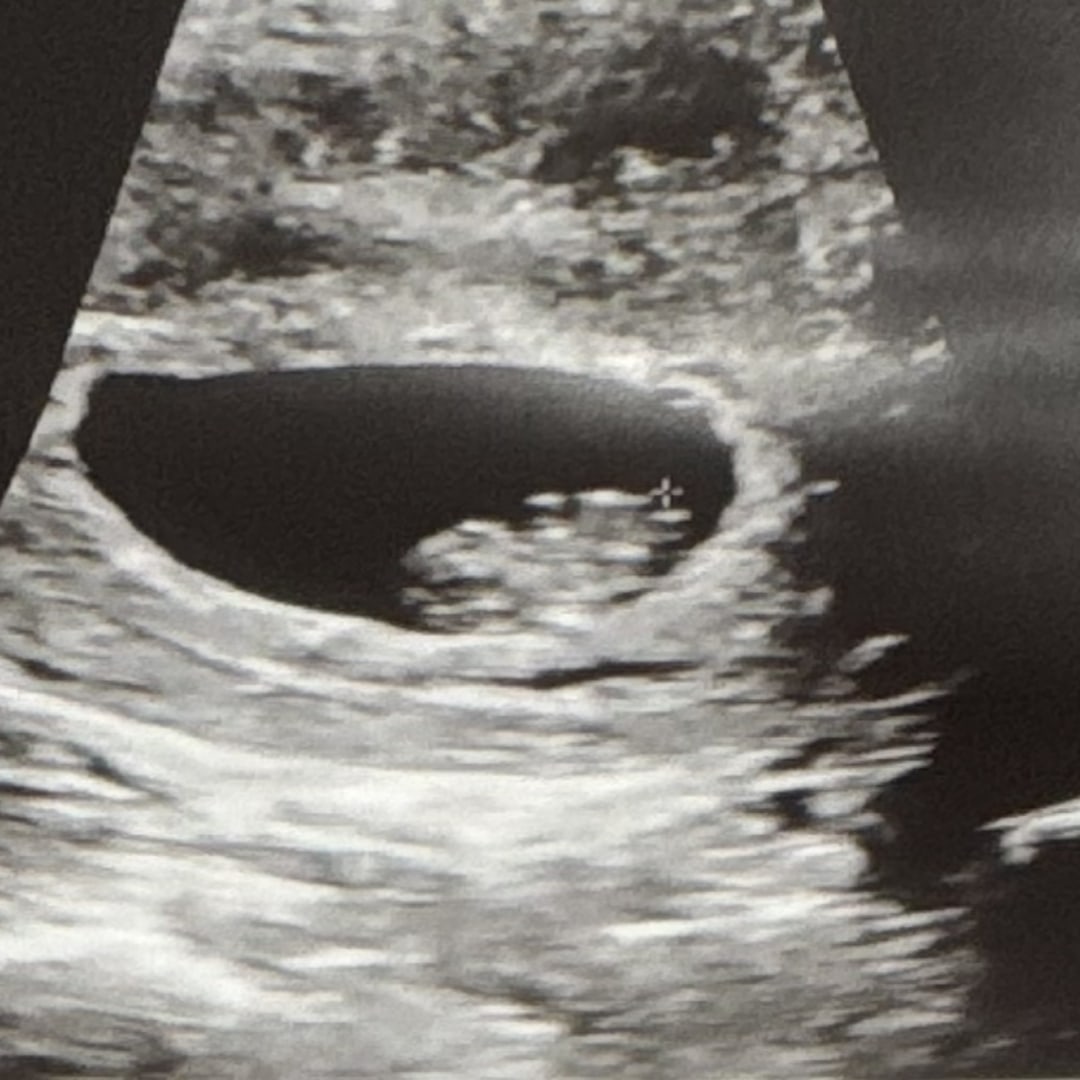 Photo shared by Jessica for their Babylist baby registry.