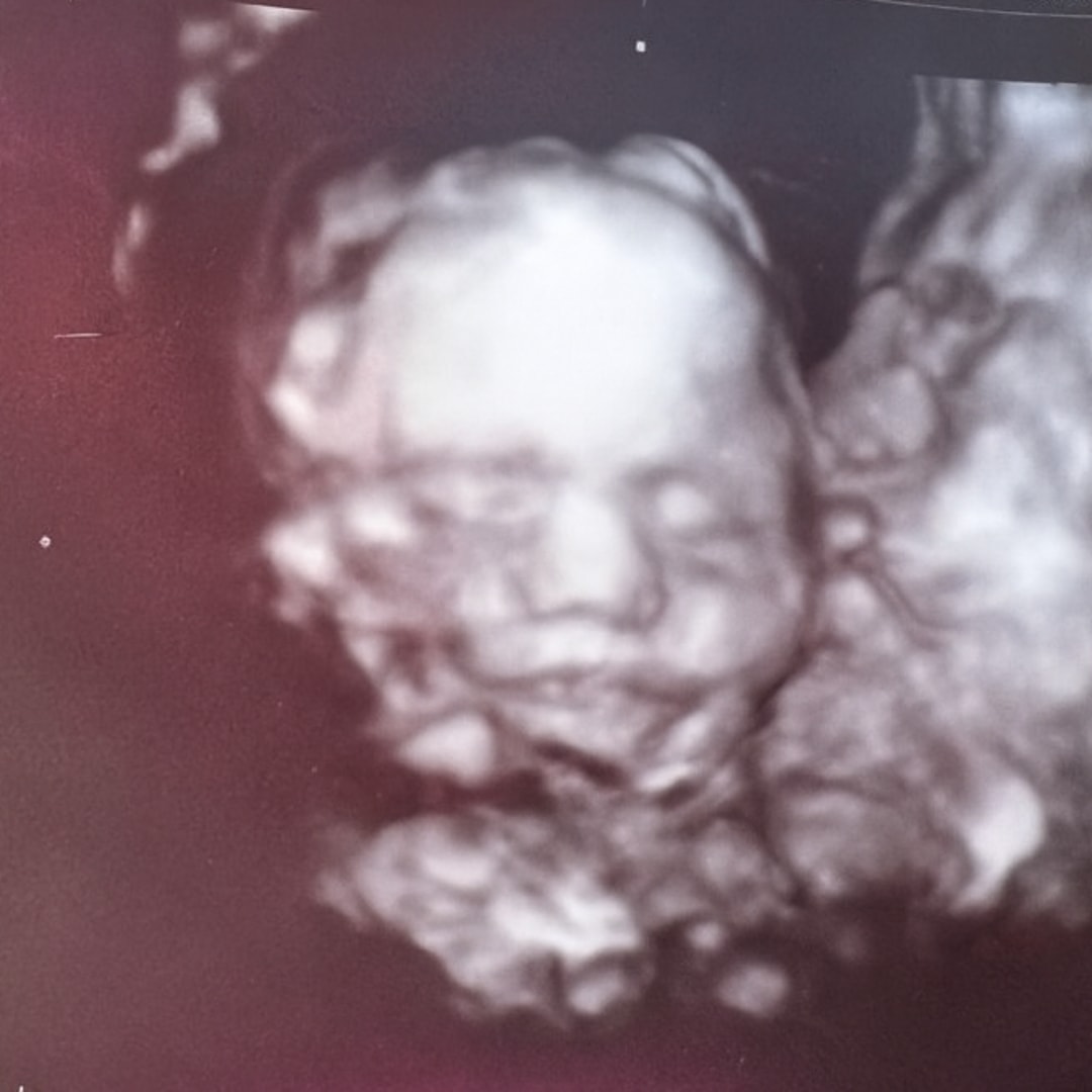 Photo shared by Chelsea for their Babylist baby registry.