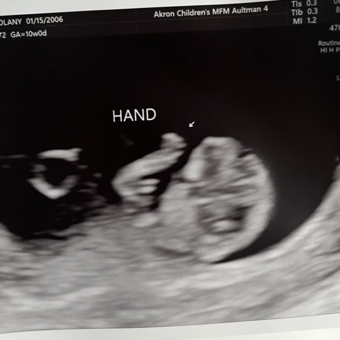 Photo shared by D’Lany for their Babylist baby registry.