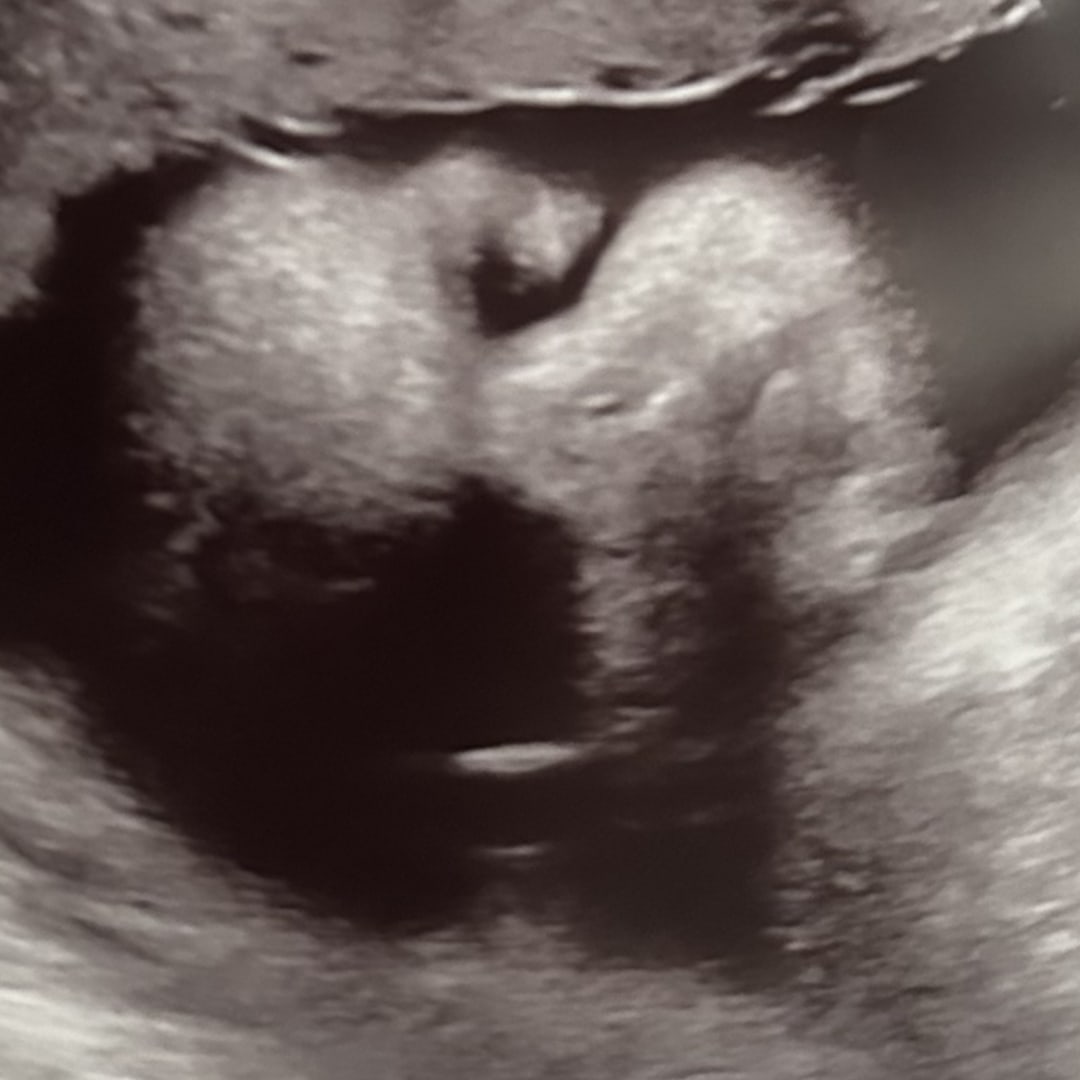 Photo shared by Jacqueline for their Babylist baby registry.