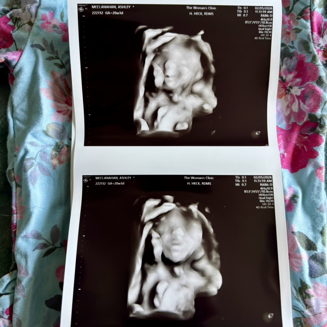 Photo shared by Ashley for their Babylist baby registry.