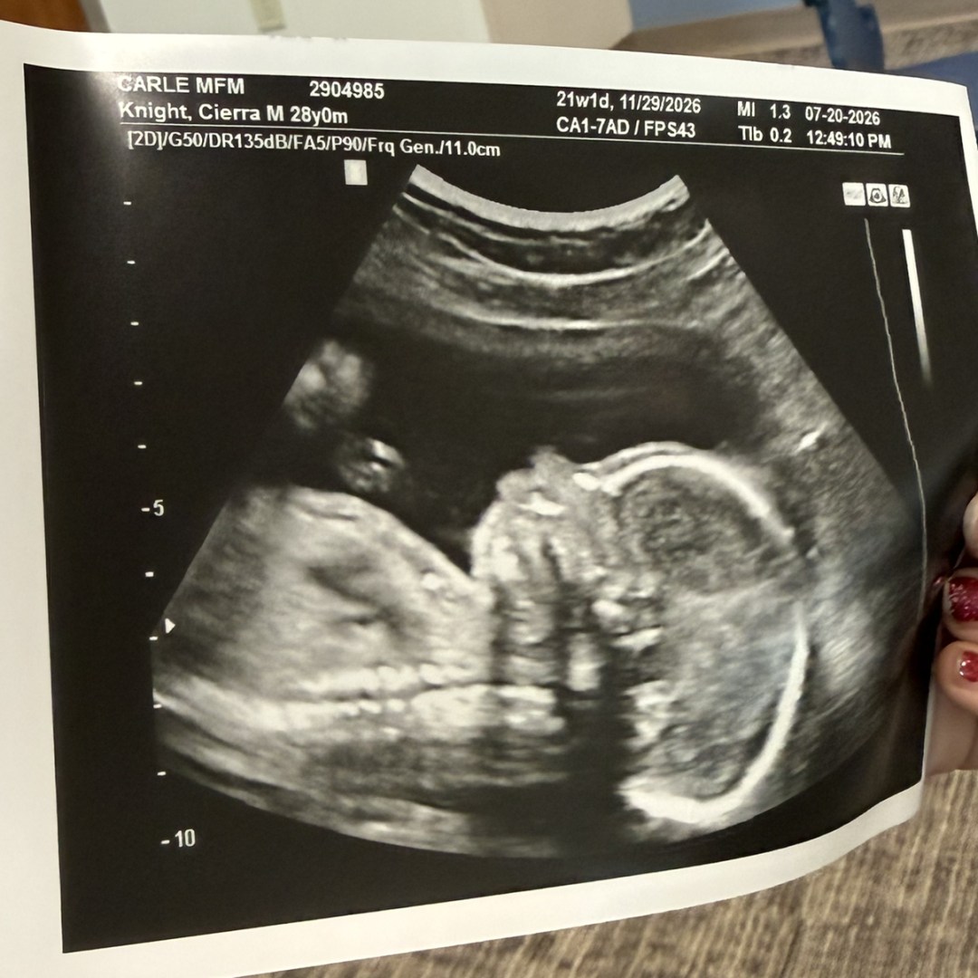 Photo shared by Cierra for their Babylist baby registry.
