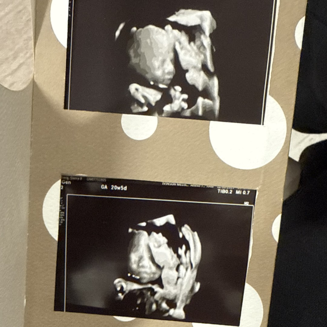 Photo shared by Sierra for their Babylist baby registry.