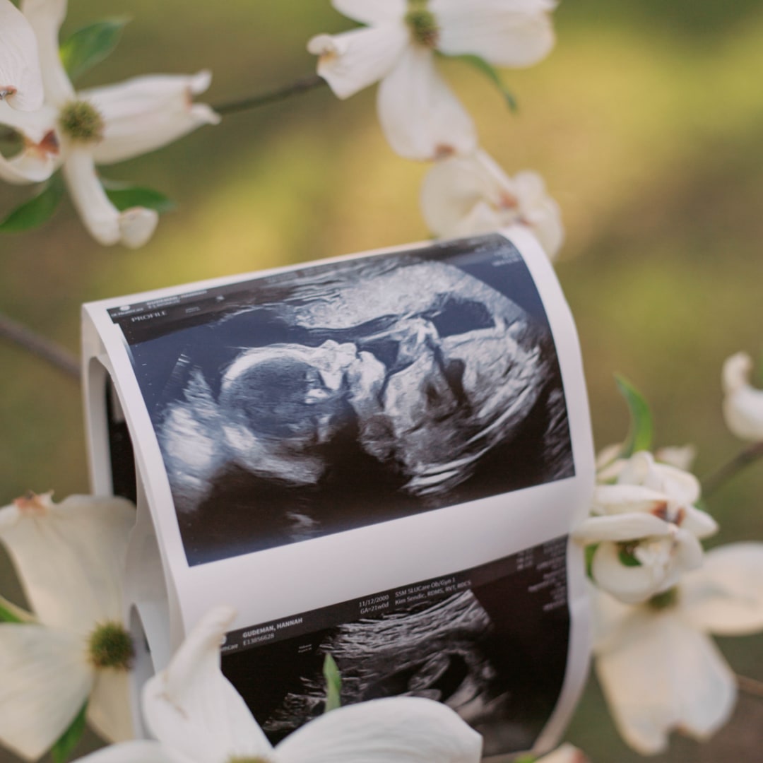 Photo shared by Hannah for their Babylist baby registry.