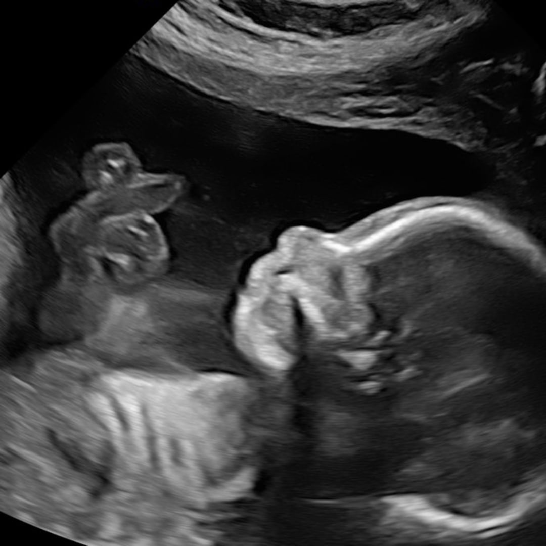 Photo shared by Christin for their Babylist baby registry.