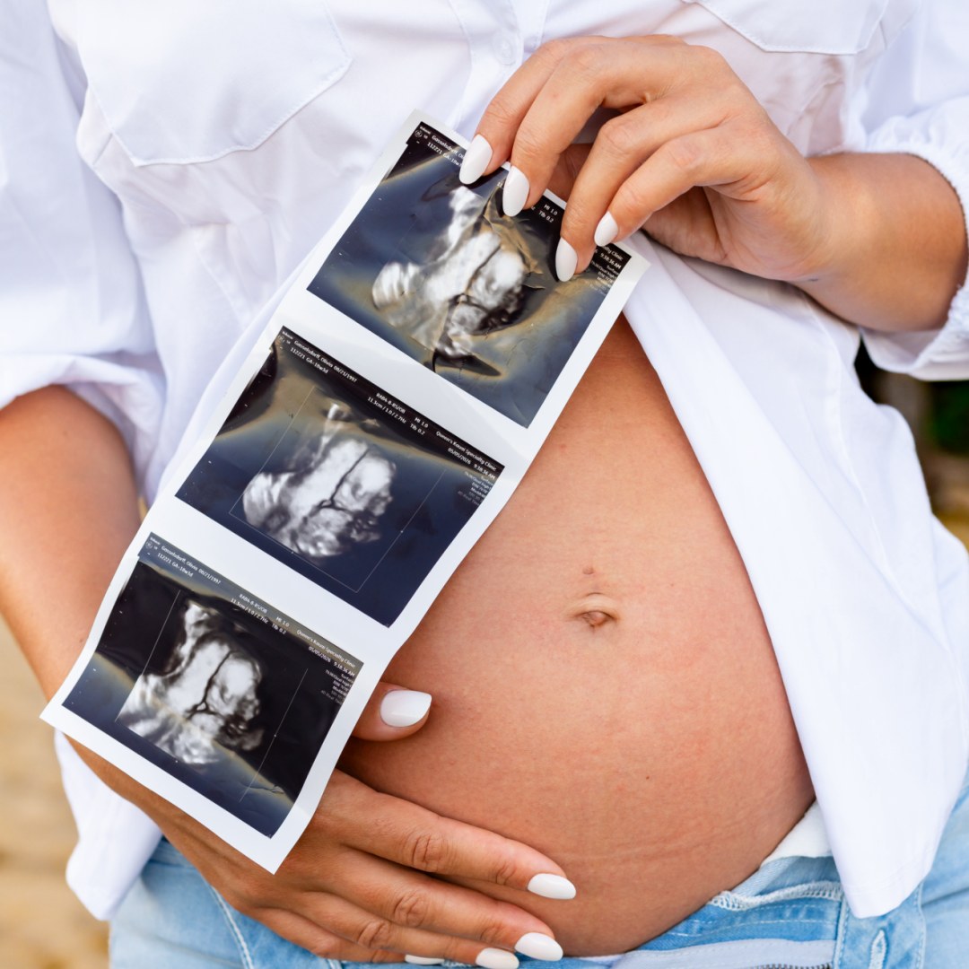 Photo shared by Olivia for their Babylist baby registry.