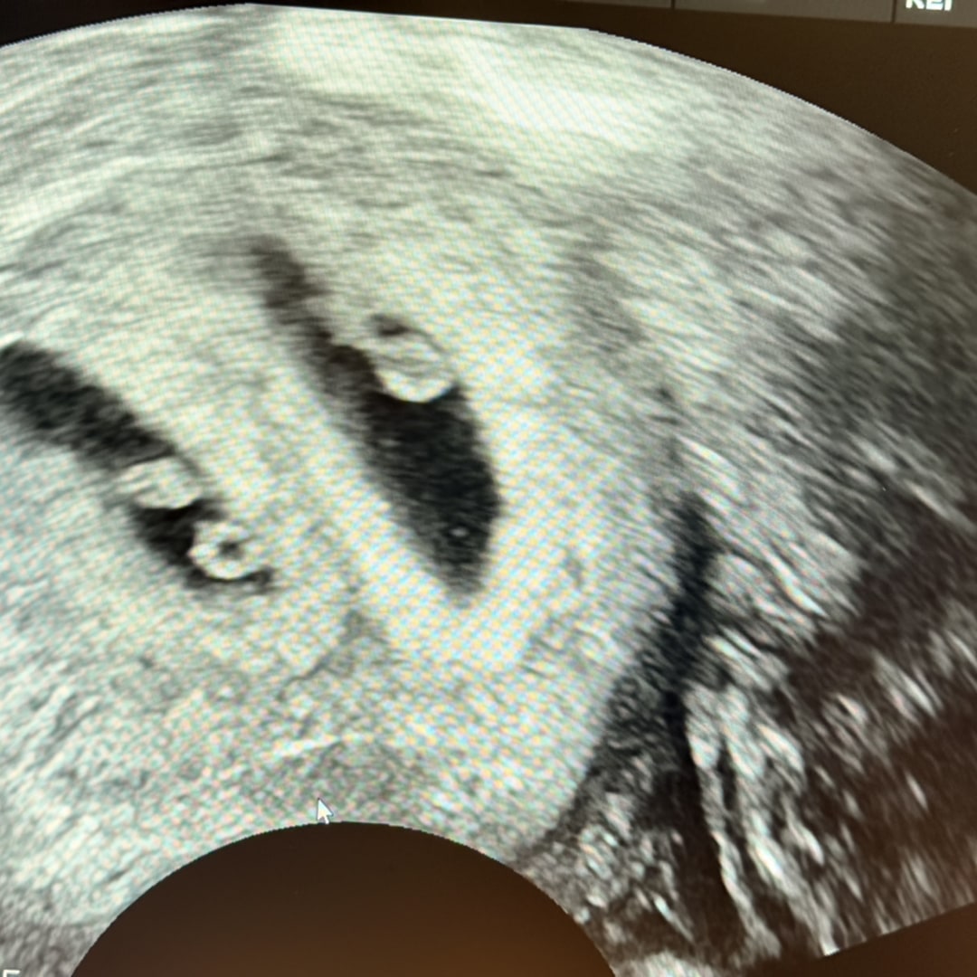 Photo shared by Tashema for their Babylist baby registry.