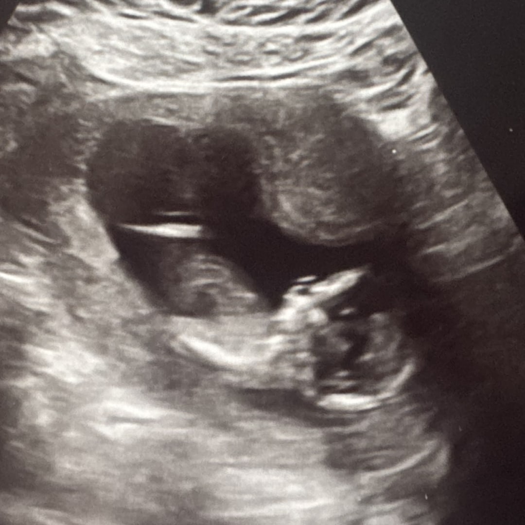 Photo shared by Victoria for their Babylist baby registry.