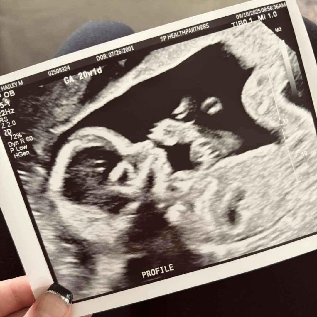 Photo shared by Hailey for their Babylist baby registry.