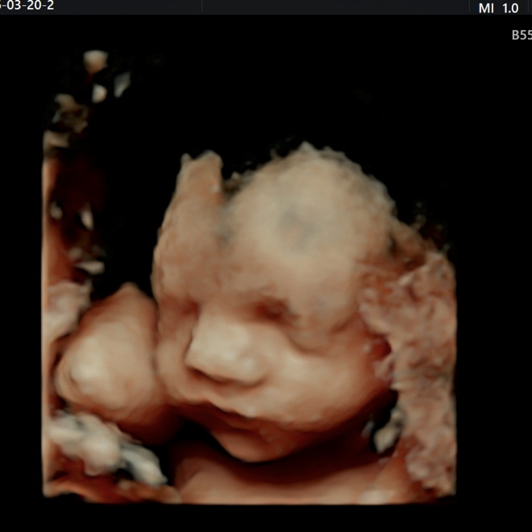 Photo shared by Rebecca for their Babylist baby registry.