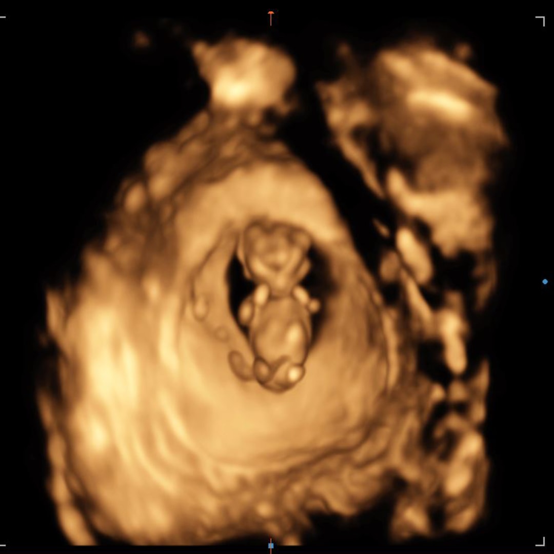 Photo shared by Shelbie for their Babylist baby registry.