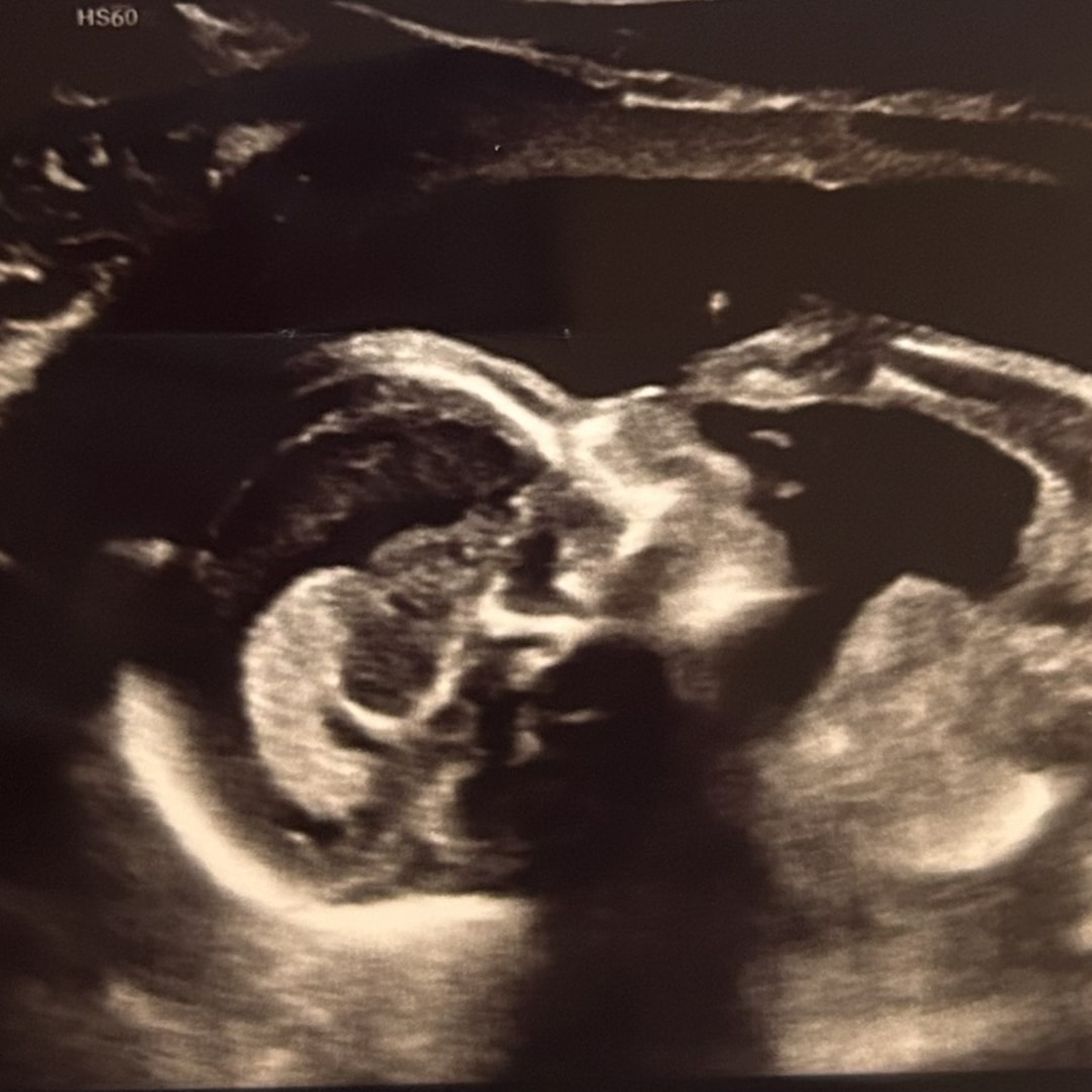 Photo shared by Caitlyn for their Babylist baby registry.