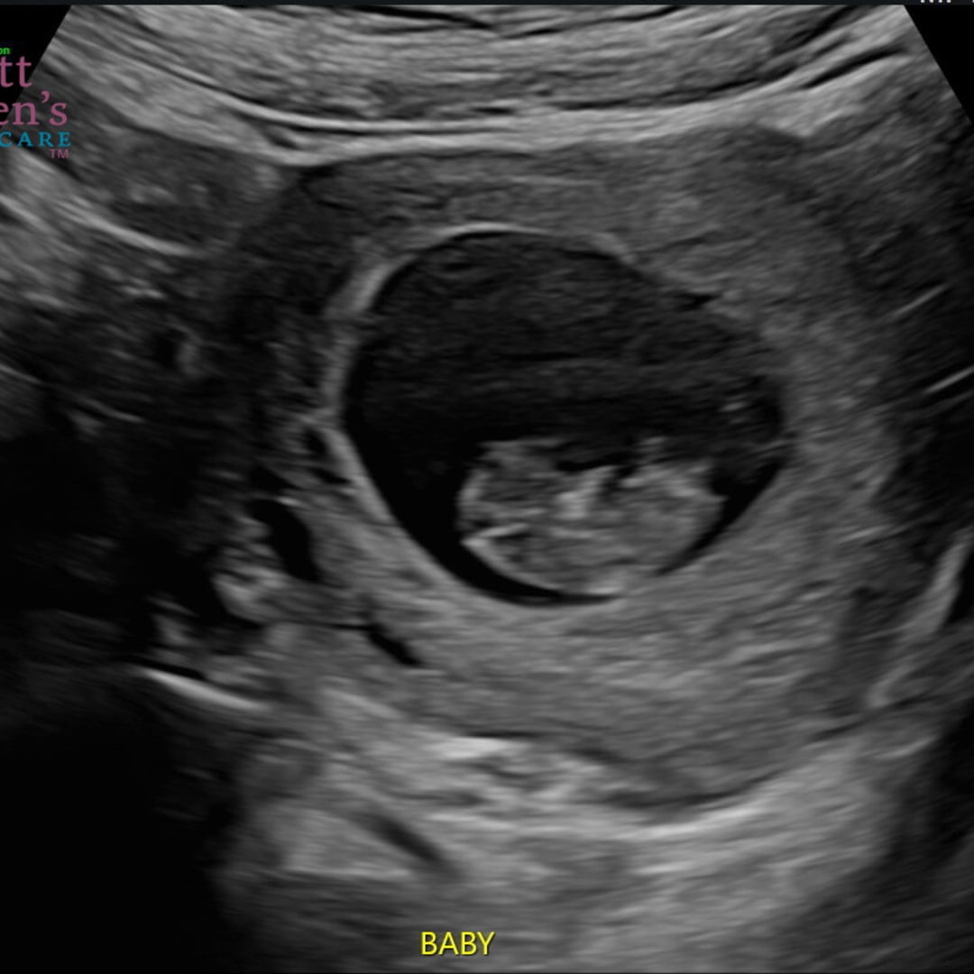 Photo shared by Morgan for their Babylist baby registry.