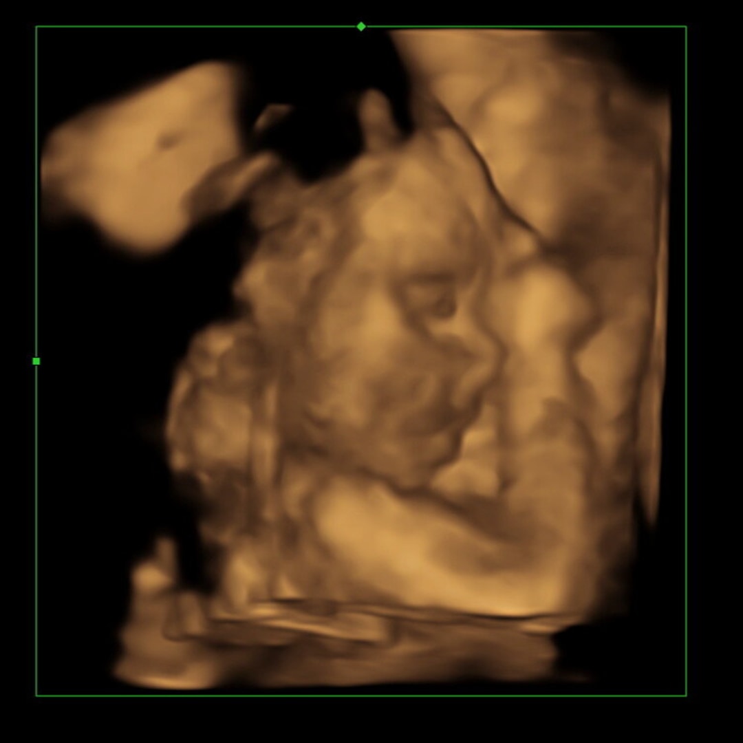 Photo shared by Brianna for their Babylist baby registry.