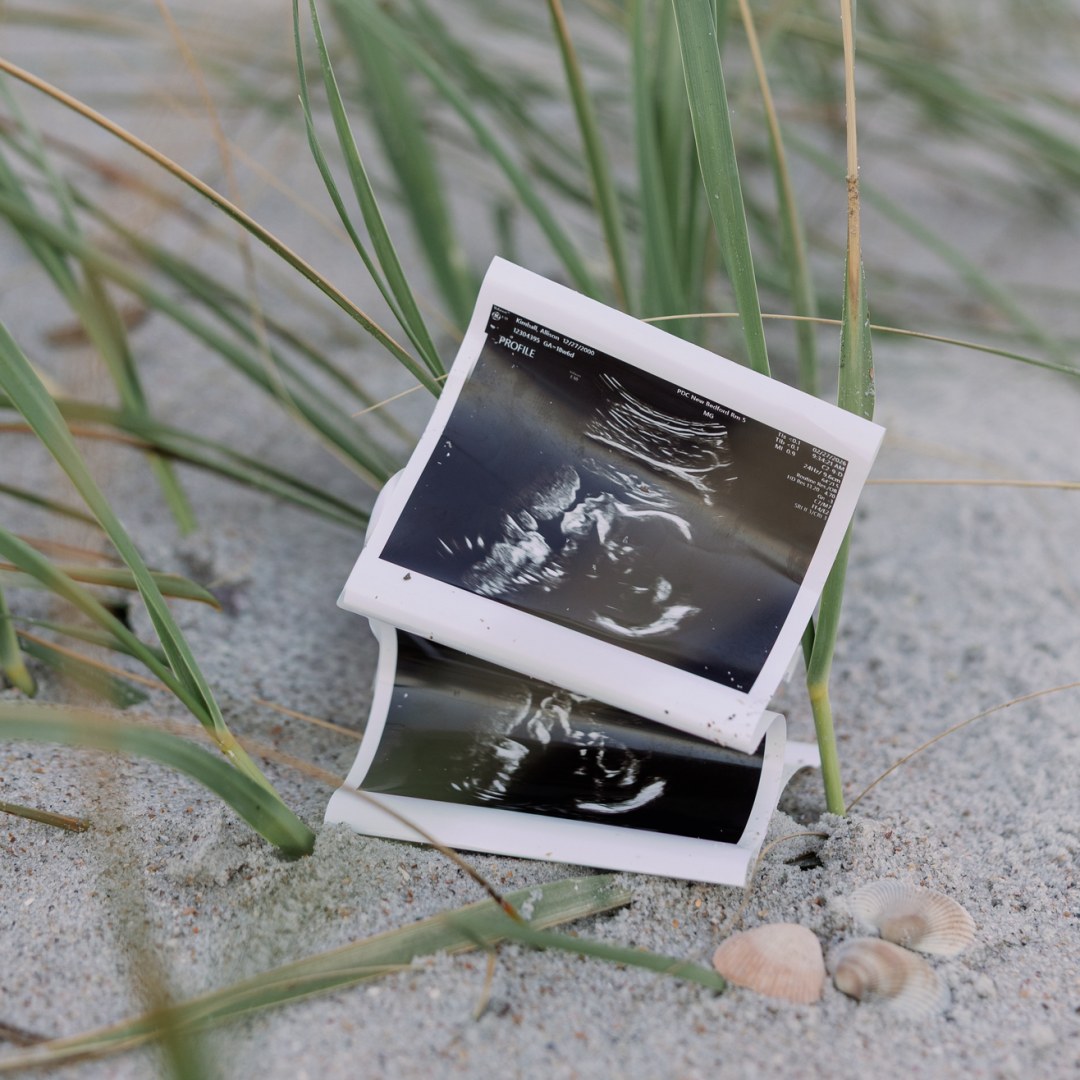 Photo shared by Allison for their Babylist baby registry.