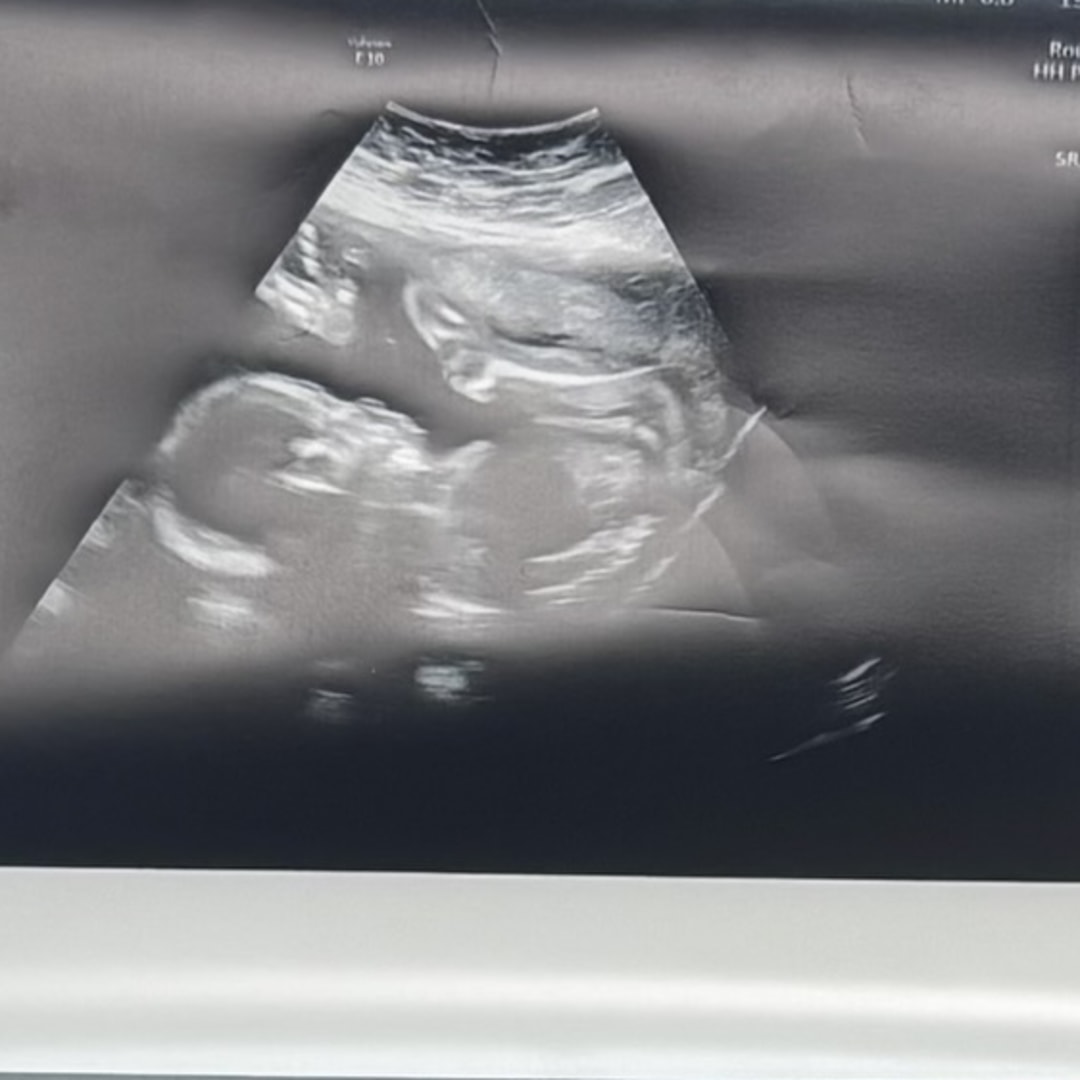 Photo shared by Jess for their Babylist baby registry.