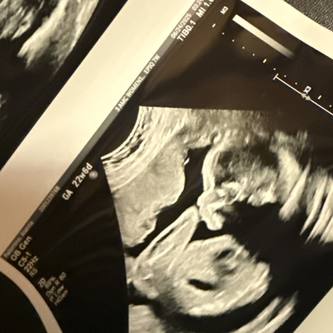 Photo shared by Alanna for their Babylist baby registry.