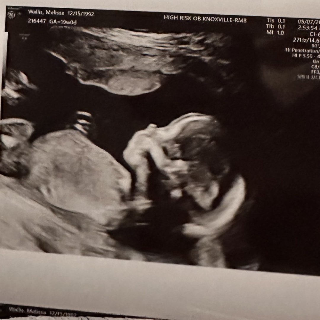 Photo shared by Melissa for their Babylist baby registry.