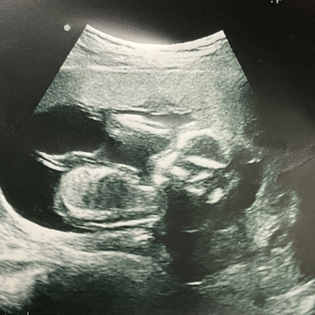 Photo shared by Ityonnuia for their Babylist baby registry.