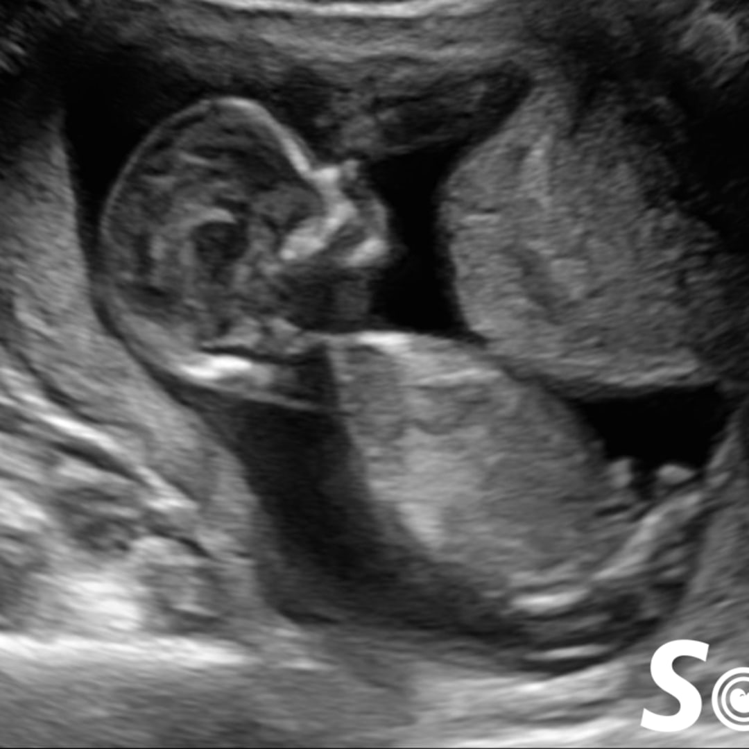 Photo shared by Aurie for their Babylist baby registry.