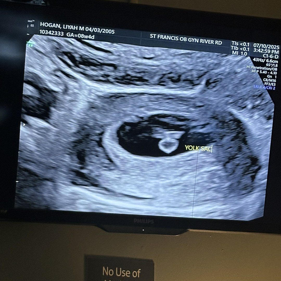 Photo shared by Liyah for their Babylist baby registry.