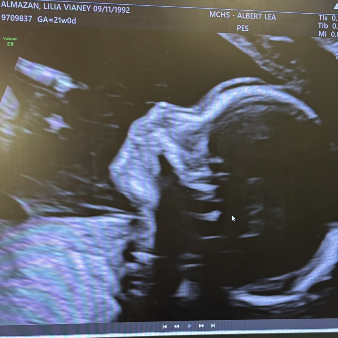 Photo shared by Lilia for their Babylist baby registry.