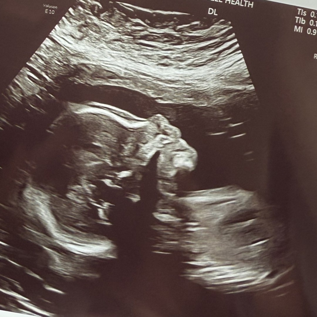 Photo shared by Loriann for their Babylist baby registry.