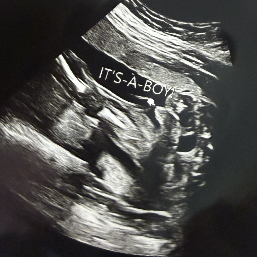 Photo shared by Lacey for their Babylist baby registry.