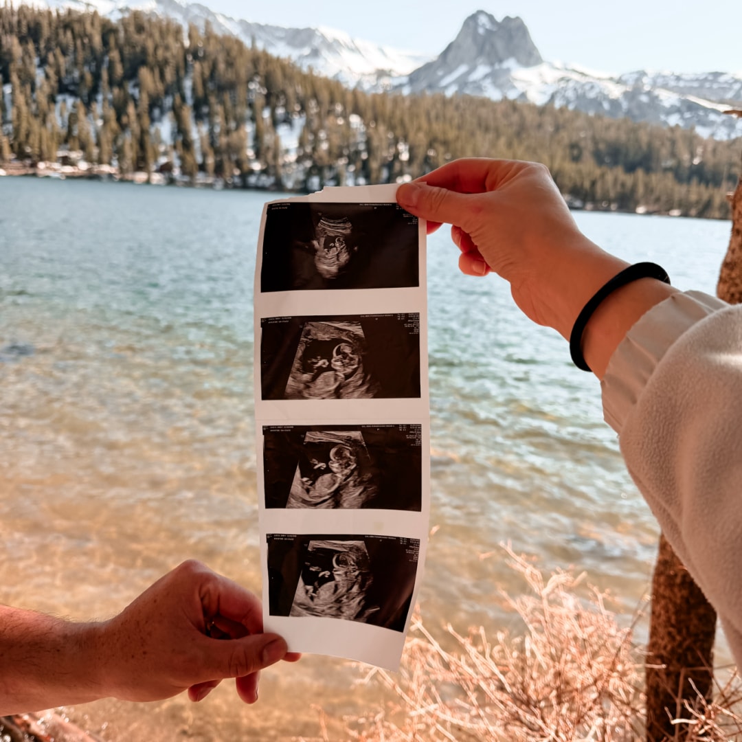 Photo shared by Emily for their Babylist baby registry.