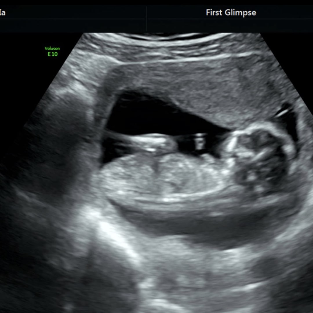 Photo shared by Mia for their Babylist baby registry.