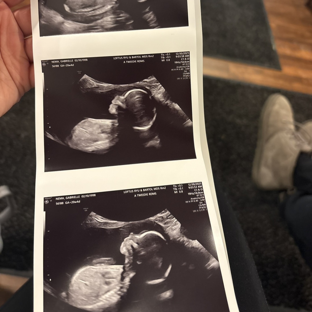Photo shared by Gabrielle for their Babylist baby registry.
