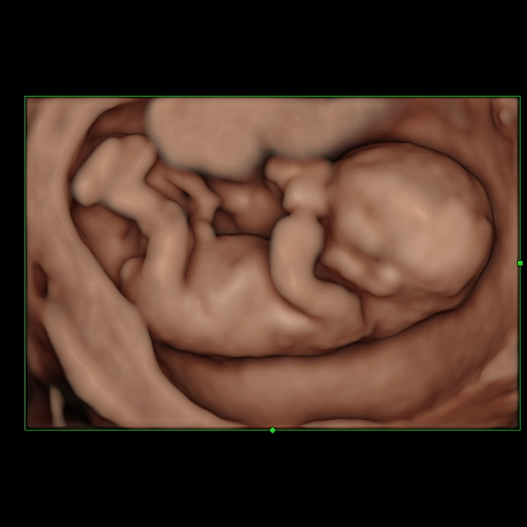 Photo shared by Catherin for their Babylist baby registry.