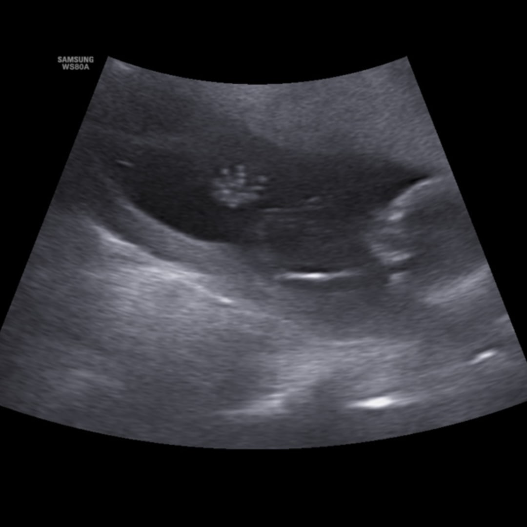 Photo shared by McKenzie for their Babylist baby registry.