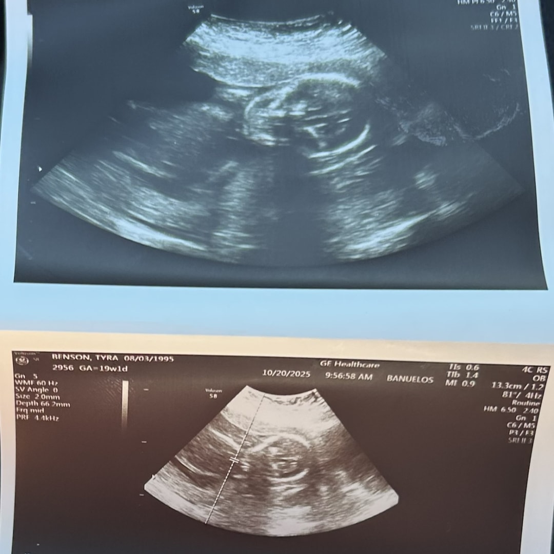 Photo shared by Tyra Ann for their Babylist baby registry.