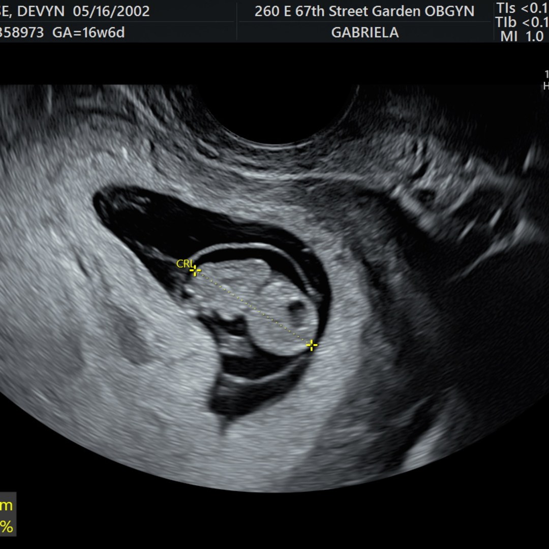 Photo shared by Devyn for their Babylist baby registry.